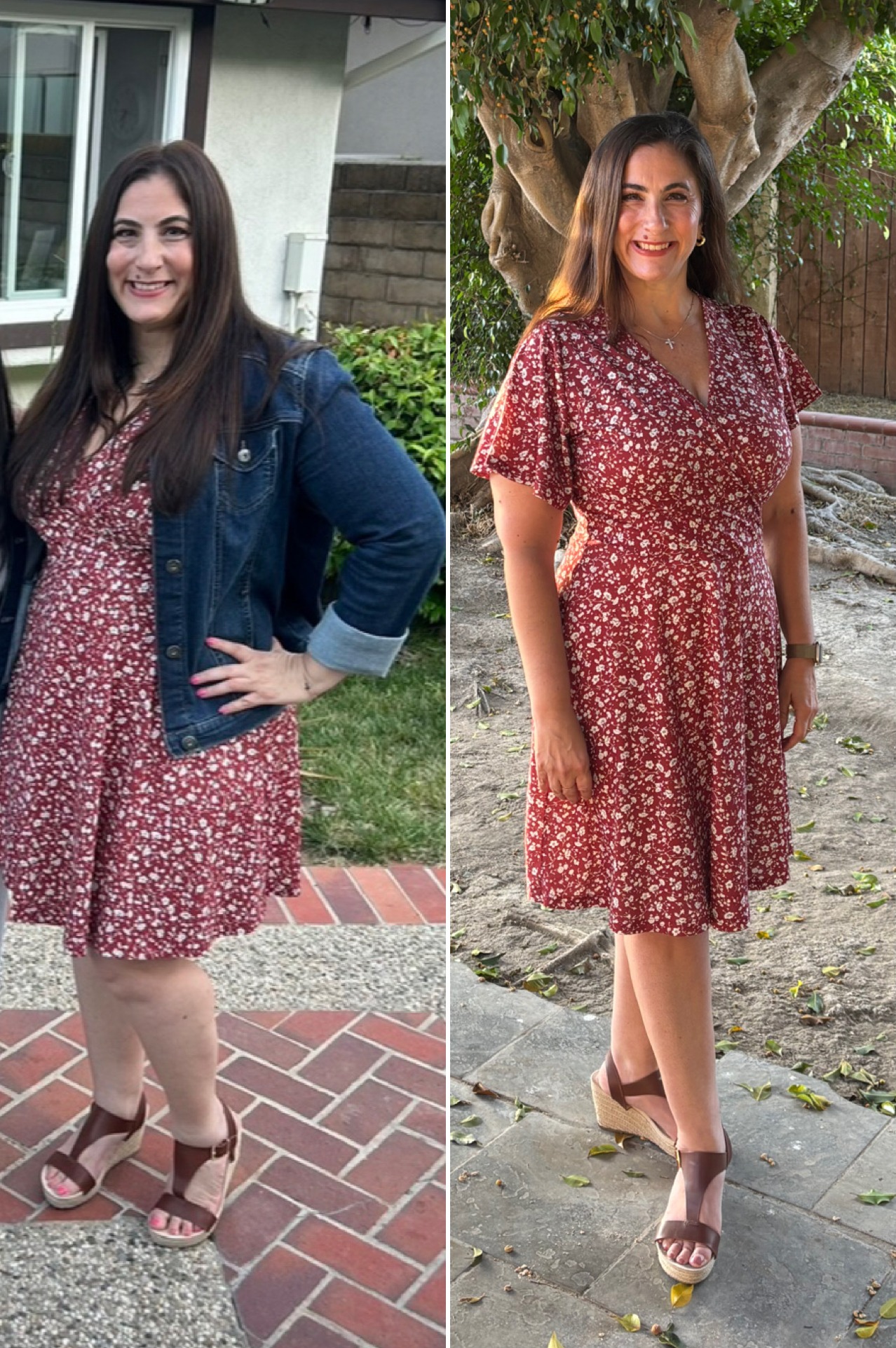 Client before and after the program, shown side by side in the same floral dress